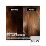 GHD Rehab Treatment Thickness